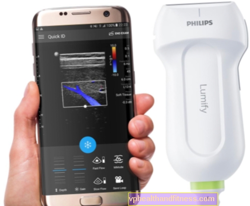 Mobilus ultragarsas - kaip veikia ši moderni ultragarso versija?
