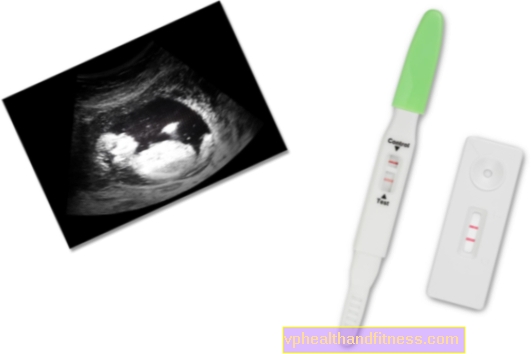 4 nėštumo savaitė - kiaušinio implantacija