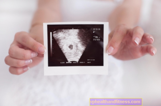 Quinta semana de embarazo: hora de una prueba de embarazo
