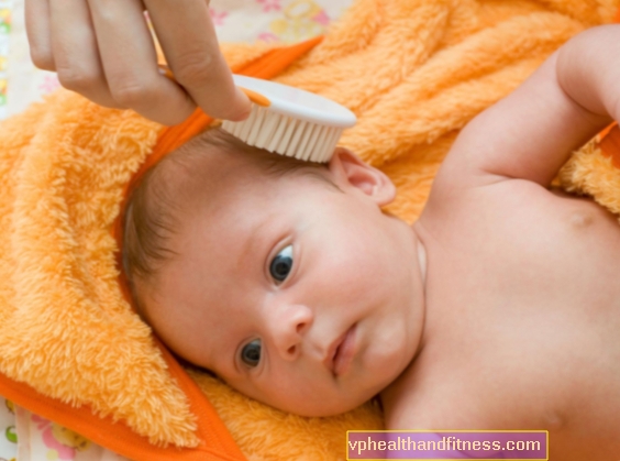 SKygger - hvordan håndteres de gule skalaer på babyens hoved?