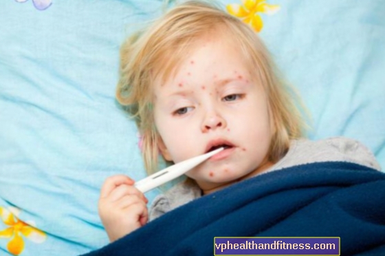 FIESTA OSPA: ¿Por qué las "fiestas de la viruela" son peligrosas para la salud de los niños?