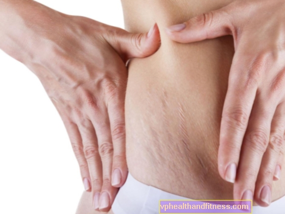 Problèmes de peau pendant la grossesse: vergetures, cellulite, peau sensible, dermatite atopique