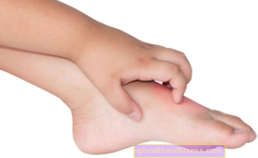 Picazón en la piel en un niño: ¿qué hacer?