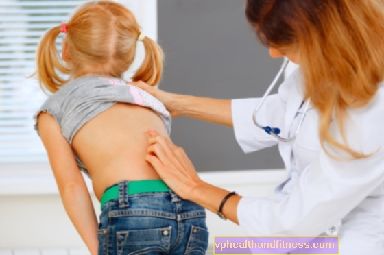 Défauts de posture chez les enfants - causes, traitement et prévention des courbures de la colonne vertébrale