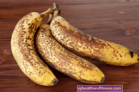 Banaanit, joissa on ruskeita täpliä - voitko syödä niitä?