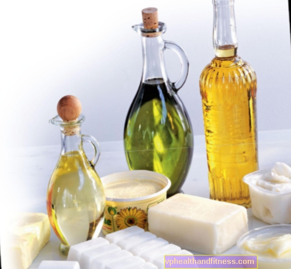 Grasas en la dieta: ¿aceite, aceite de oliva, mantequilla o margarina?