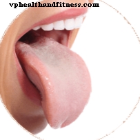 Oral candidiasis: årsager og behandling