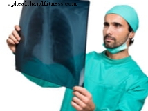 U lympho phổi - Triệu chứng