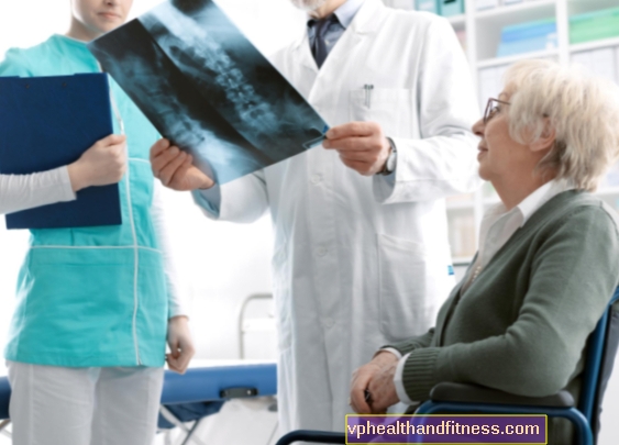 Osteoporosis suficiente: diagnóstico, tratamiento, prevención