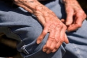 Parkinsonas: ne tik judėjimo problema