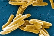 Le génome du bacille de la tuberculose découvre son origine et ses faiblesses