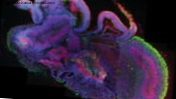 Как е създаден човешкият „мини-мозък“ в лабораторията