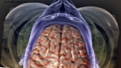 De finner hjerneområdet ansvarlig for motoriske lidelser ved schizofreni