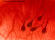 Zvýšené riziko rakoviny u mužov, ktorí neprodukujú spermie