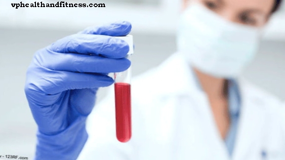 Fibromyalgi-screening i blodprøver