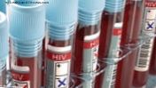 Genetiske variationer kunne stoppe AIDS