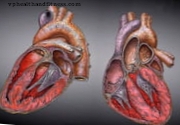 Néhány, a szívrohamot követő károsodásban lévő sejt gyógyulhat