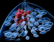 Pronašli su četiri nova proteina na koja djeluju u zloćudnim procesima karcinoma dojke
