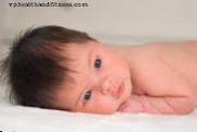 एक अध्ययन के अनुसार लगभग आधे शिशुओं के सिर पर सपाट धब्बे होते हैं