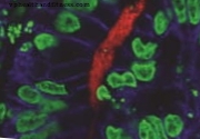 Američtí vědci vytvářejí lidské „mini žaludky“ z kmenových buněk