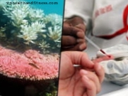 Australijos korale esantys baltymai blokuoja ŽIV virusą