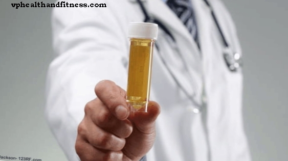 Exames de urina para detectar câncer