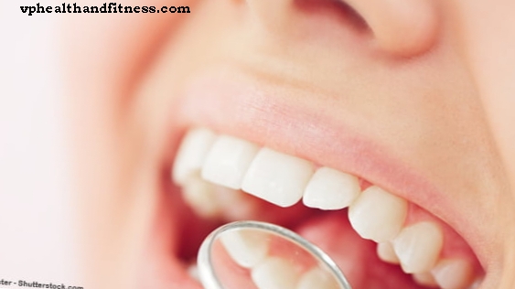 Naujos dantenų uždegimo priežastys