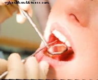Акупунктурата може да помогне по време на стоматологична консултация