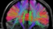 Detaliausias žmogaus smegenų žemėlapis