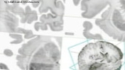 Susipažinkite su „Google Earth“ žmogaus smegenyse