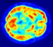 Разработете „баркод“, за да картографирате мозъка