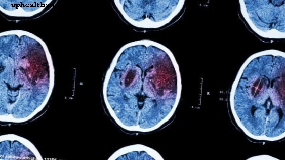 Підтвердіть зв’язок між герпесом та хворобою Альцгеймера