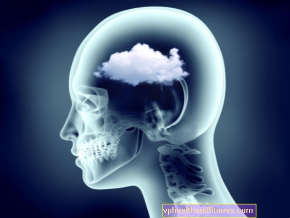 Brouillard cérébral (brouillard cérébral) - symptômes et traitement