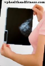Godartad bröstpatologi - Diagnos och behandling