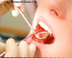 Pencegahan dan rawatan miokosis mulut