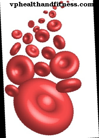 Лечение на хемохроматоза: кървене или флеботомия