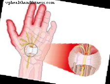 Причини и лечение на изтръпване в ръцете