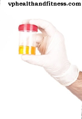 Urinski testi: proteinurija, citobakteriološki test urina, hemoglobinurija