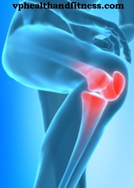 Omezte bolest při artritidě