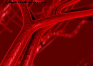 Пернициозна или мегалобластна анемия