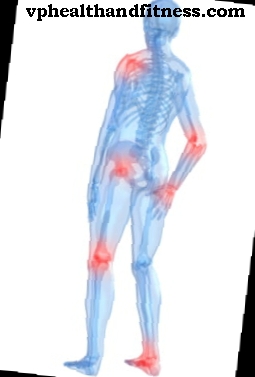 Berita dalam rawatan rheumatoid arthritis