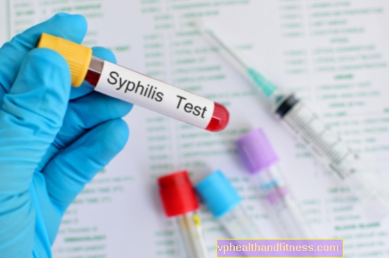 Pregled sifilisa - koji će testovi otkriti sifilis i kada ih raditi?