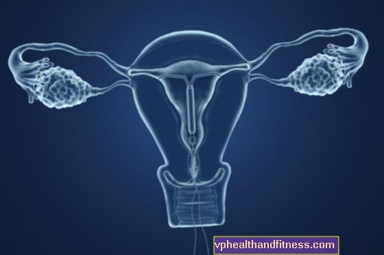 Implante anticonceptivo: ¿cómo funciona? ¿Es seguro y eficaz?
