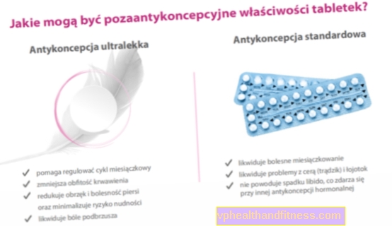 Cómo elegir las píldoras anticonceptivas, es decir, anticoncepción a medida
