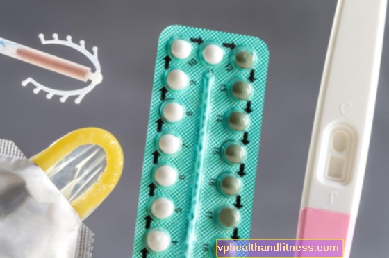 ¿Qué método anticonceptivo es mejor para ti?