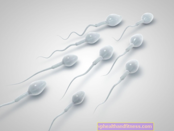 Barva spermií - co to znamená? Barva spermií a její vliv na plodnost