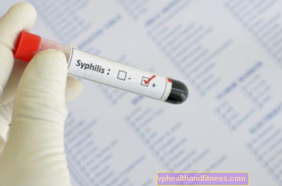 Efektivní léčba syfilisu (syfilis) penicilinem, doxycyklinem, tetracyklinem. Jak dlouho to trvá a jak to vypadá?