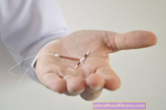 INSERT (IUD, spiral): en præventionsmetode for den glemsom