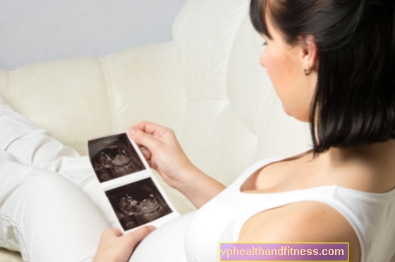 Prueba prenatal: ¿que es y cuando se hace?