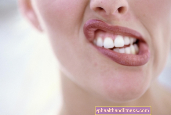 Бели петна по зъбите - причини. Как мога да се отърва от тях?